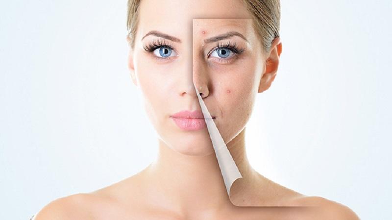 Mất ngủ phá huỷ làn da như thế nào?